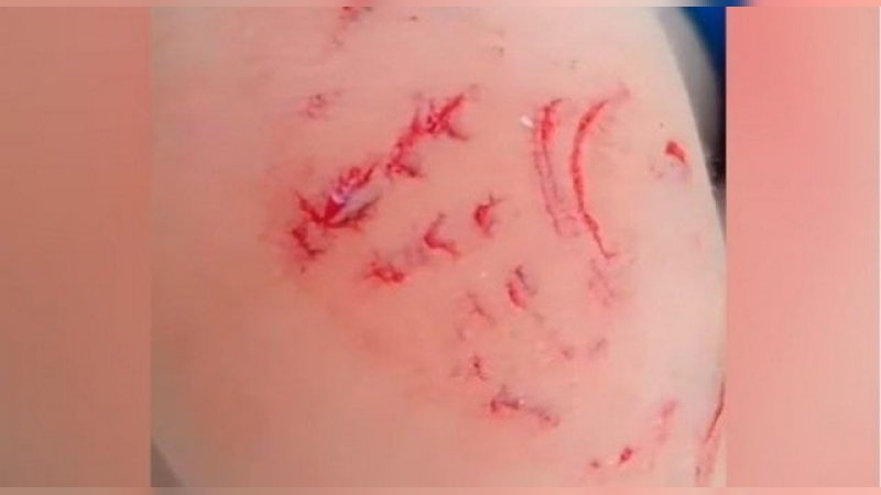 Ataque Tararira a niño en Córdoba